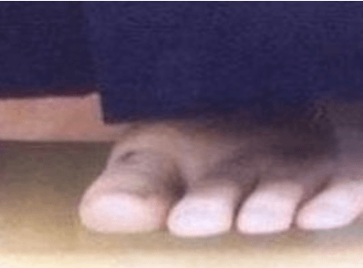 阿部サダヲさんの足の親指の画像